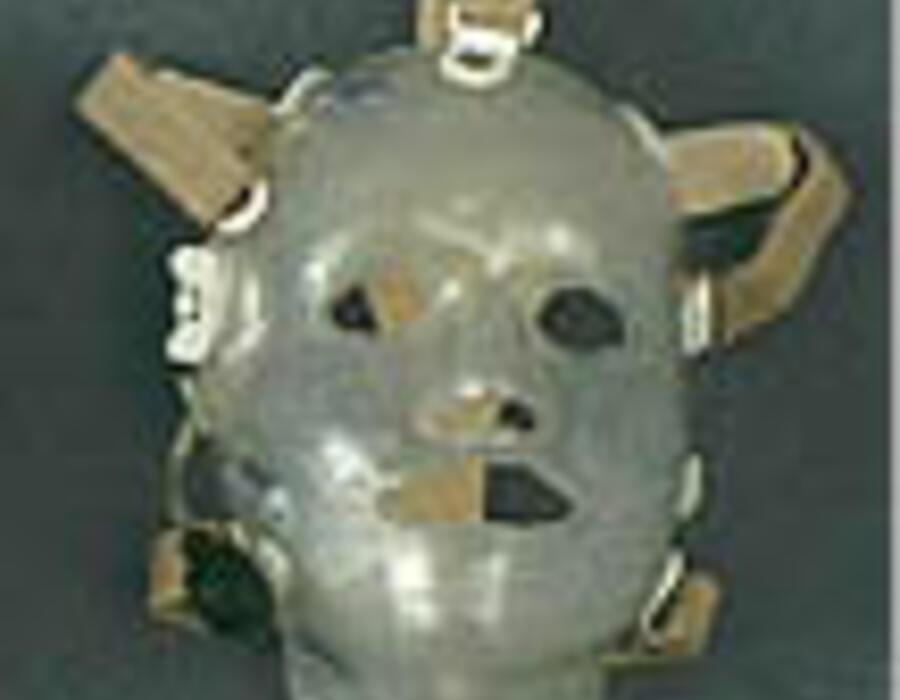 burn-mask_otto_bock_silicon_house_duderstadt.jpg
